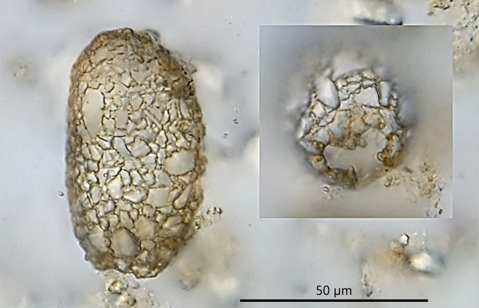 Difflugia baculosa